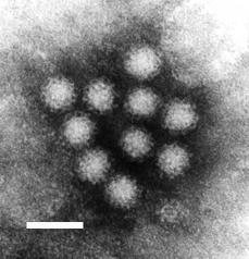 ノロウイルスを顕微鏡で見た写真